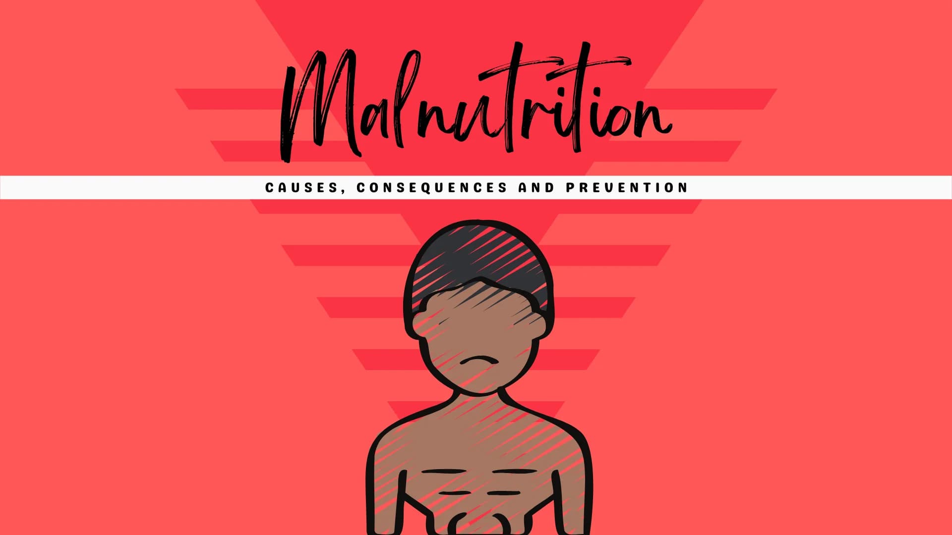 Malnutrition – Causes, Consequences and Prevention